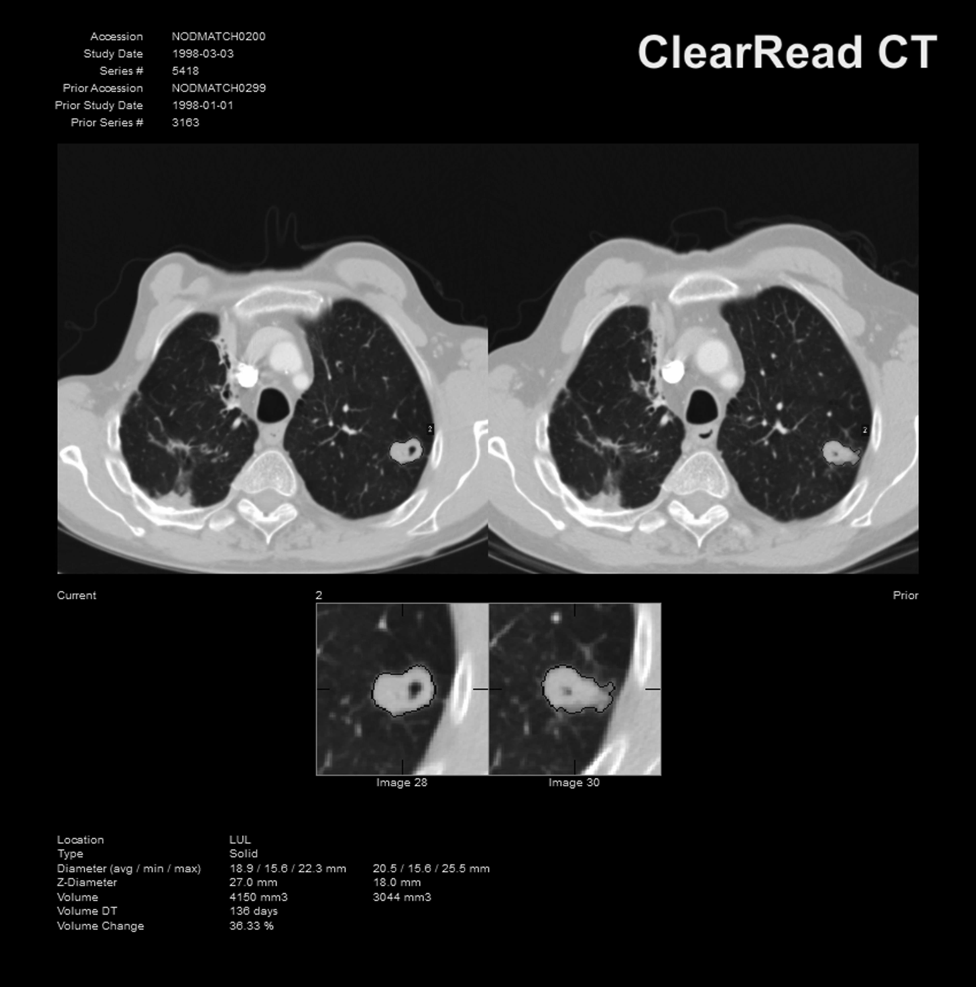 ClearRead Xray