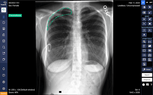 Draid™ - AI For Radiology